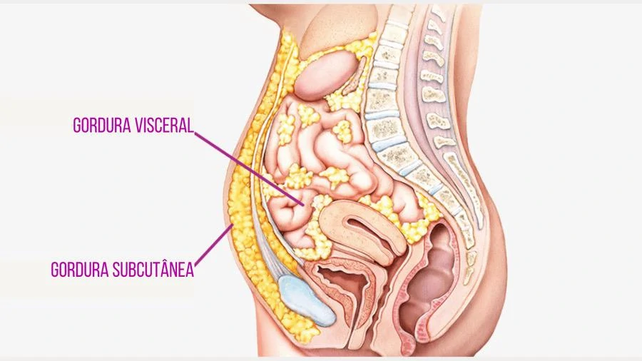 como secar a barriga